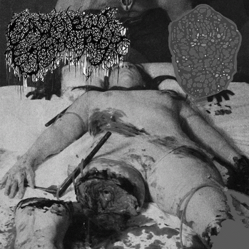 Inhalando Cerebro Seco De Perro : Gangrenous Erythromelalgia - Inhalando Cerebro Seco de Perro Inhalando Cerebro Seco De Perro : Gangrenous Erythromelalgia - Inhalando Cerebro Seco de Perro